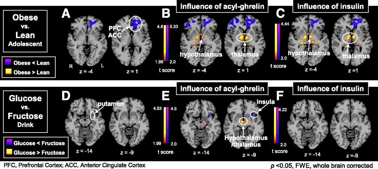 How Fructose Affects the Brain