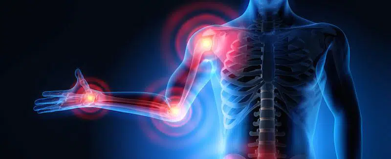 Inflammation in Formulas